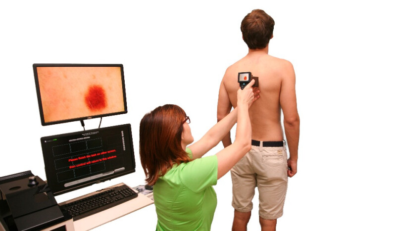 “MoleMax” digitālās dermatoskopijas iekārta