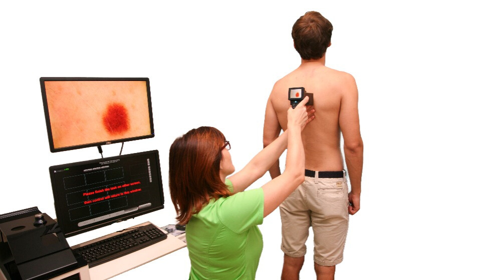 “MoleMax” digitālās dermatoskopijas iekārta